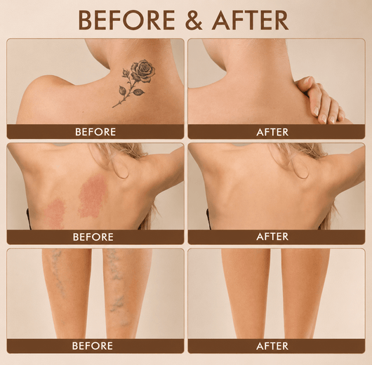 Luvella Body Perfector